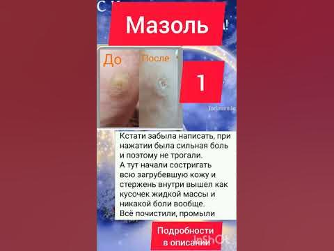 Подробности в описании к каналу #мазоль - YouTube