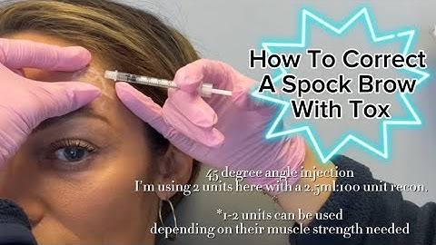 How to Fix A Spock Brow From Tox