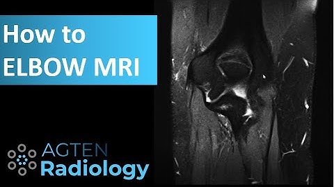 How to assess Elbow MRI