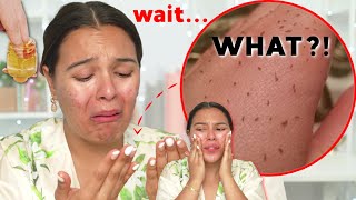 I TRIED OIL CLEANSING AND THIS HAPPENED…😳Uhhh...