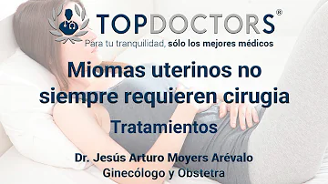 ¿Ayuda el ejercicio a los fibromas?