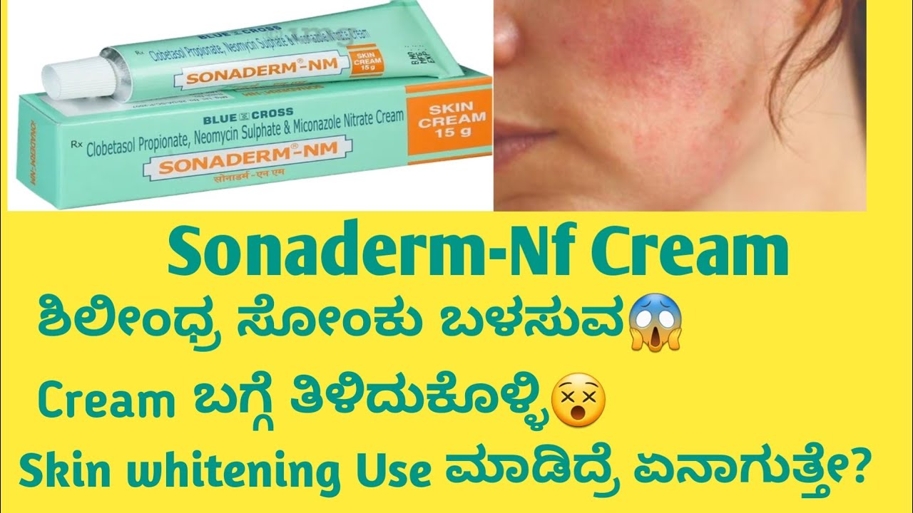 Sonaderm Nf Cream information in kannada|Uses|side effects 