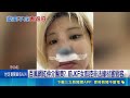 百萬網紅牽線做鼻雕 前JKF女郎控遭毀鼻失業 鼻雕3年後"異物衝破鼻頭" 網紅驚線材不合法?｜三立新聞LIVE