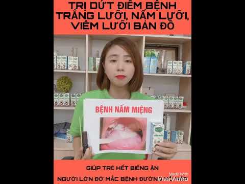 Cách trị bệnh nấm lưỡi, nấm miệng, tưa lưỡi, viêm lưỡi bản đồ, hôi miệng - Dạ Thảo Liên 0963146392