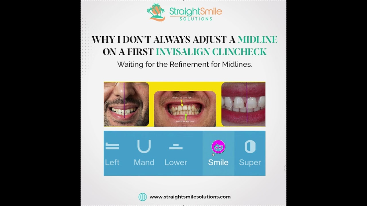 Why I don't NORMALLY Adjust Midlines or use Elastics on a First Invisalign Clincheck