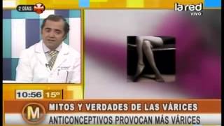 La de venas píldora anticonceptiva varicosas