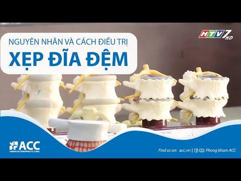 Video XẸP ĐĨA ĐỆM: Nguyên nhân và Phương pháp điều trị -... - youtube