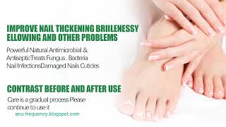 Herbal Nail Fungus Remedy: Vital Information That Really Works screenshot 2