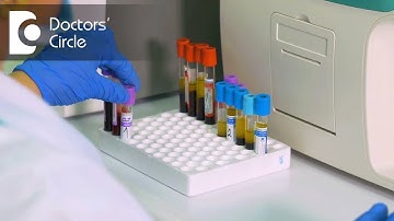 What are the TATs for common Biochemistry tests? - Dr. Samit Thakur