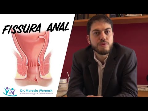 Vídeo: Ânus Rígido: Causas, Sintomas E Tratamento