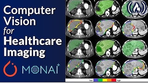 Master PyTorch and MONAI for AI Healthcare Imaging – Python Machine Learning Course (2025)