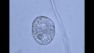 Predators: Suctoria Sphaerophrya parameciorum  attacking paramecium