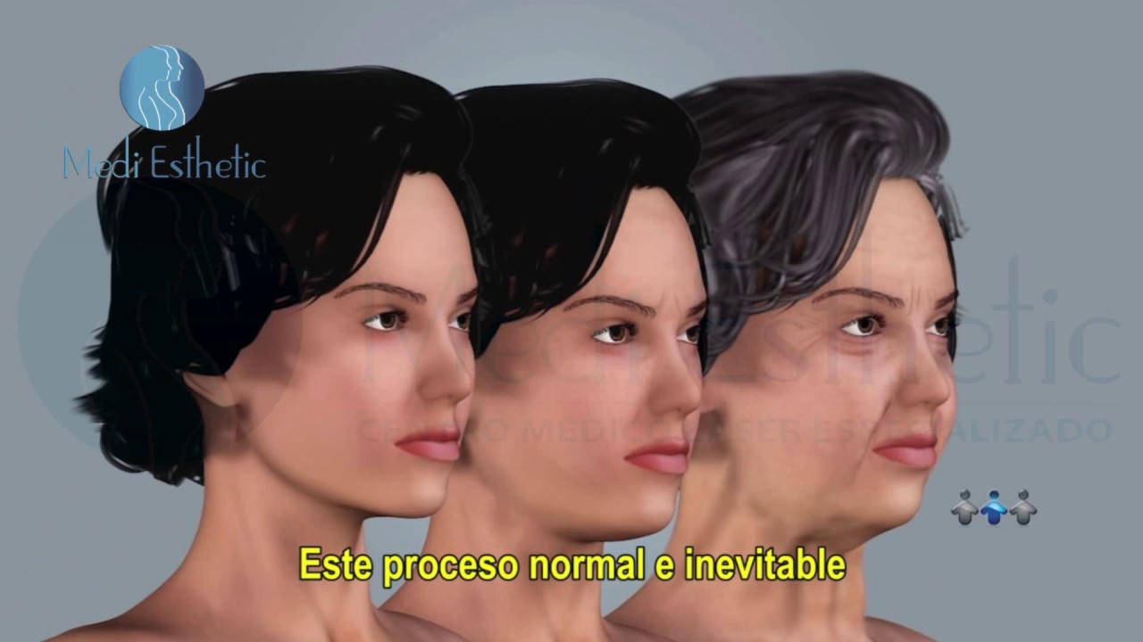 ¿Cómo funciona la Carboxiterapia?