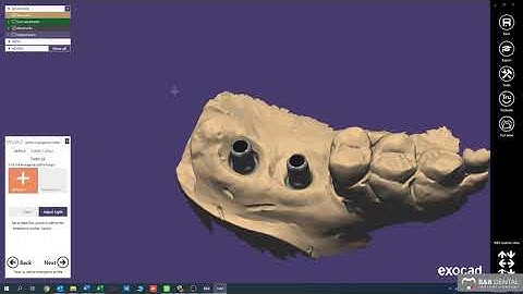 B&B Dental | how to use scancap and scan body - EXOCAD