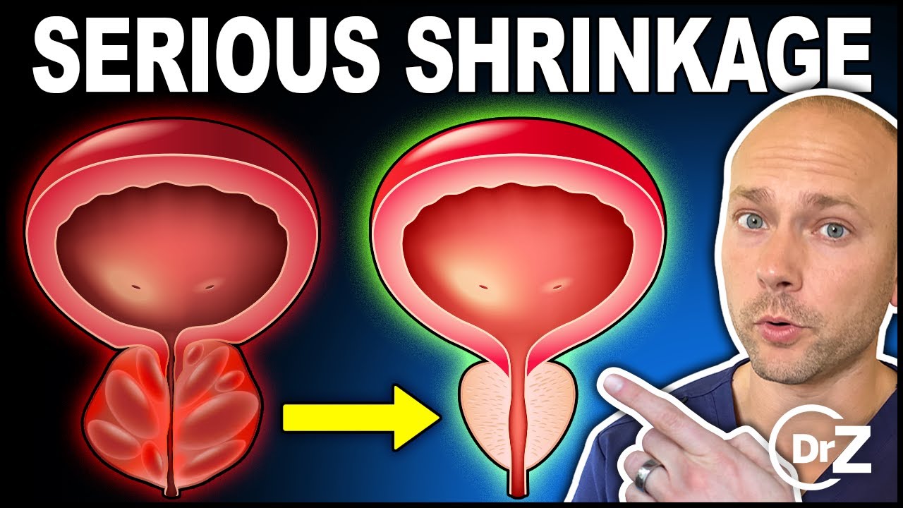 5-critical-vitamins-that-shrink-your-prostate-youtube