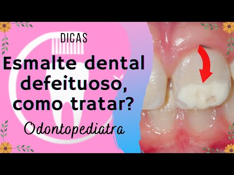 Vídeo: Como restaurar o esmalte dentário (com fotos)