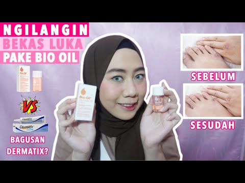 Lebih bagusan produk bio oil atau dermatik ???!!!. 