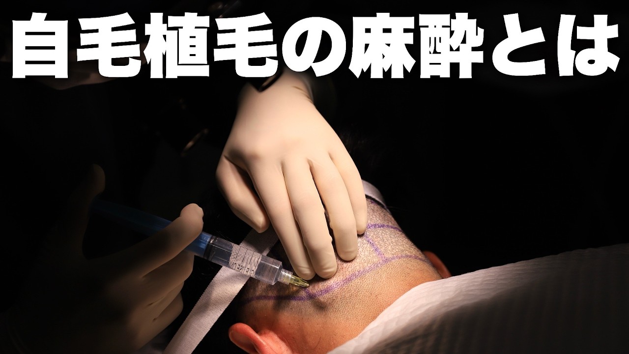 Painless? Painful?] Explaining anesthesia for hair transplantation