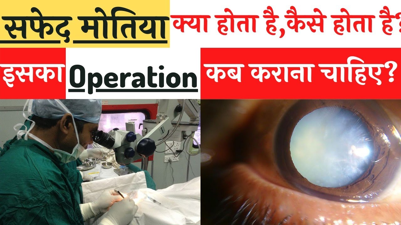 Cataract in hindi|Cataract ,reason and treatment | Safed motia kya hota