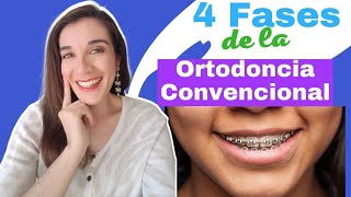 4 PHASES OF ORTHODONTIC TREATMENT that you should know. What is my treatment about?