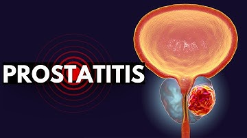 Prostatitis Demystified: From Diagnosis to Relief