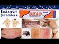 Skab cream uses permethrin cream 5 uses and side effects in urdu hindi scabies treatment 