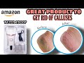 Electric Feet Callus Remover Device|| Amazon Great Buy