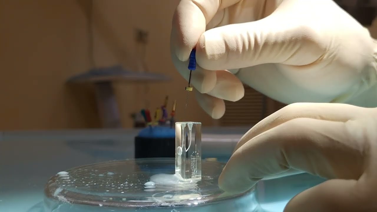 Протокол обработки канала файлами MG3 II EUROFILE от доктора Решетина Александра