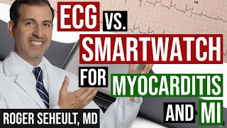 ECG/EKG Versus Smartwatch for Myocarditis/Pericarditis and Myocardial Infarction