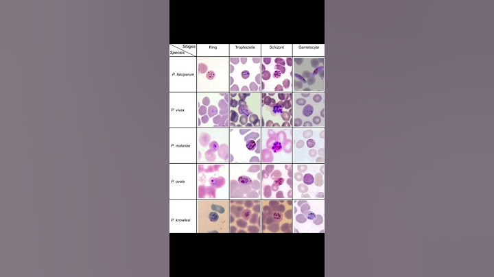 Malaria parasite in peripheral blood smear under microscope 🔬 #malaria #parasites #microscope#viral