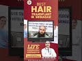 🎥 Watch real customer reviews of the best hair transplant clinic in Srinagar – Cosmo Hair Clinic!
