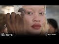 [watch video] Cool to know that albinism is just a color 