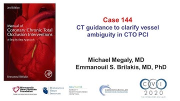 Case 144: Manual of CTO PCI - CT coregistration for clarifying ambiguity