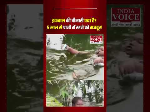 इकबाल की बीमारी क्या है? 5 साल से पानी में रहने को मजबूर! #virelvideo #shortvideo #indiavoice