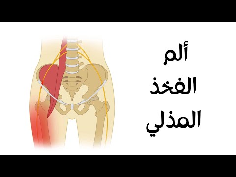 فيديو: ما هو انخفاض الورك الشبيه بالكوب؟