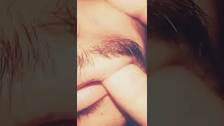 #blackheadcaique #satisfying #thebarbersarms #salon #relax #haircare #ingrownhair #satisfyingvideo