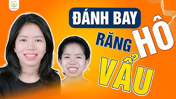Bị Chê Cười Vì Răng Hô, Vẩu – Hành Trình Lột Xác Ngoạn Mục | Bác sĩ Trung Long Biên