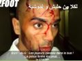 إصابة لموشية و حليش من طرف الصعاليك المصرية 