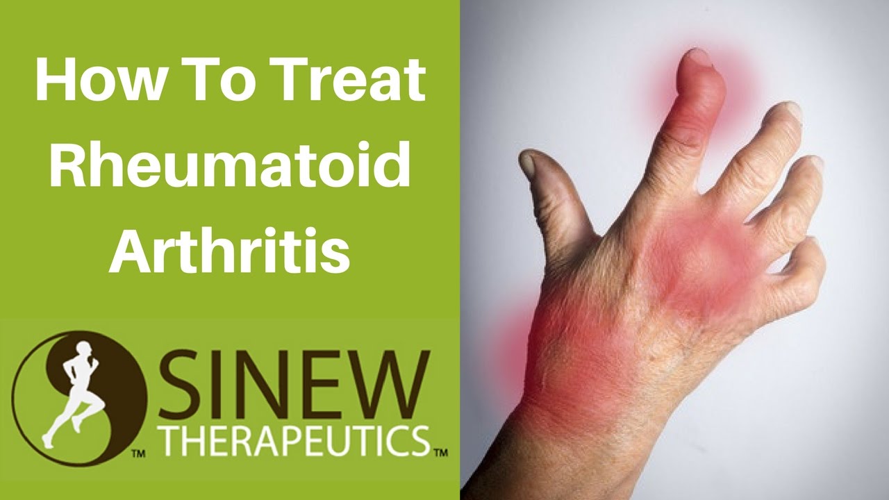 How To Treat Rheumatoid Arthritis and Speed Recovery