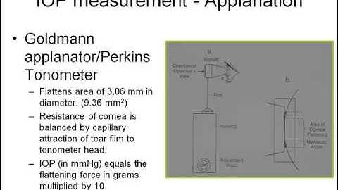 The Basic Glaucoma Exam