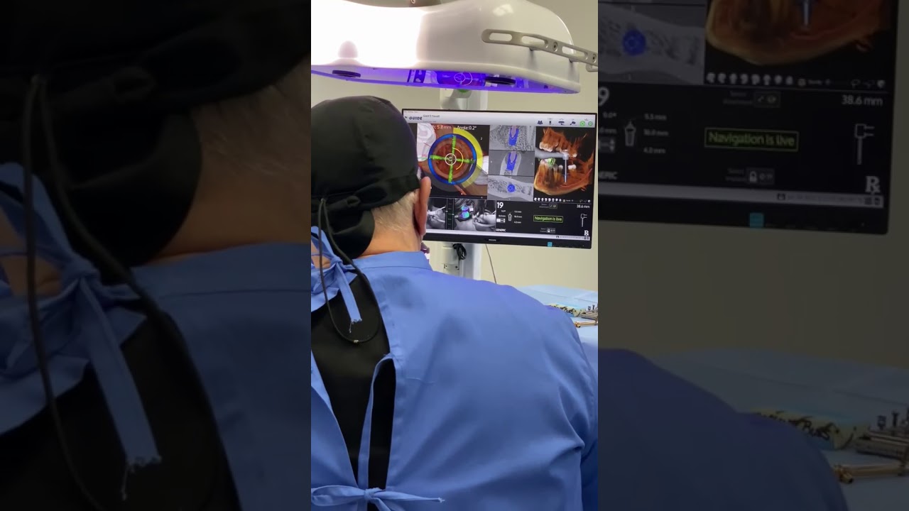 Computer-Assisted 3D Navigation for Precise Implant Placement