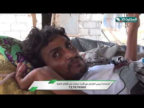 حالة إنسانية | أربعيني يعاني من إصابة طلق ناري في العمود الفقري اثناء التهريب | سنابل الخير