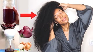 UTILISEZ LA DÉCOCTION D'OIGNON POUR UNE POUSSE EXTRÊME DE VOS CHEVEUX | PAS D'ODEUR DÉSAGRÉABLE !