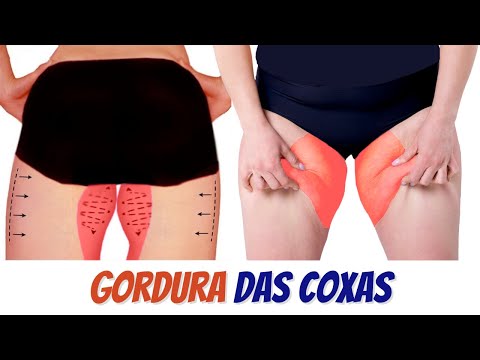 Vídeo: 3 maneiras de perder peso na parte superior da coxa