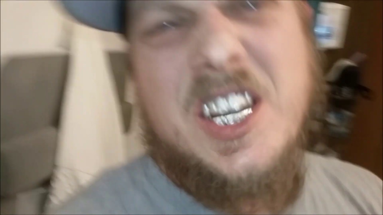 Grillzlife 103 How to Clean your Grillz YouTube