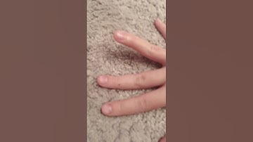 “You can’t lift your index finger by its self.”