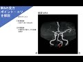 【MRA　ウィリス動脈輪　脳血管の探し方のポイント！！】　＃Circle of Willis　理学療法士国家試験・作業療法士国家試験　PT・OT・ST・看護師　＃理学療法士　＃作業療法士　＃国試