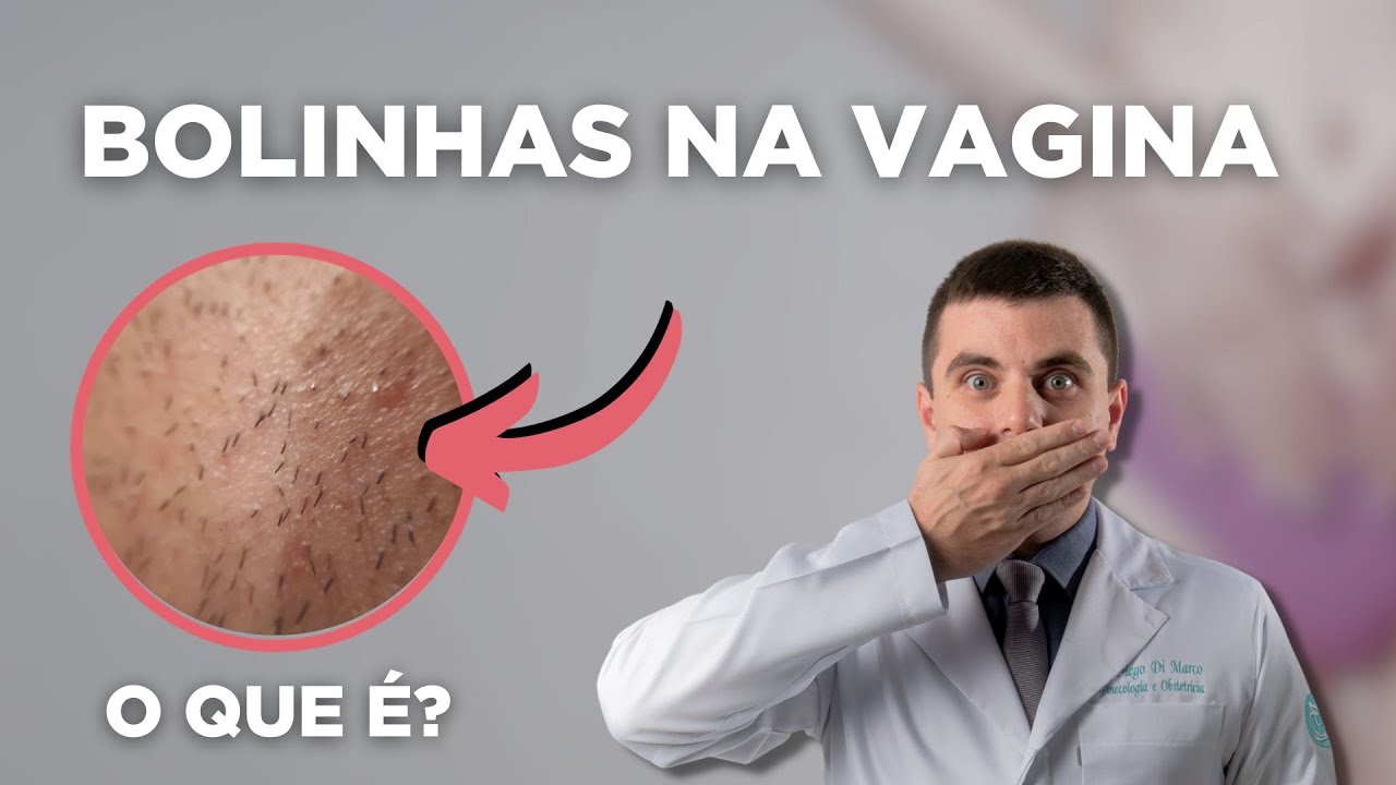 BOLINHA na VAGINA , o que é? 