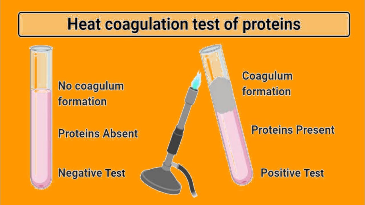 Heat And Acetic Acid Test For Proteinuria Heat Coagulation, 57 OFF