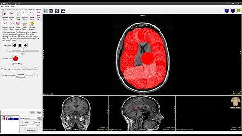 Analyze 15.0 - Segment: Freehand Draw 2D Region Definition